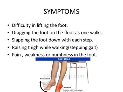 tests for foot drop|unable to dorsiflex foot.